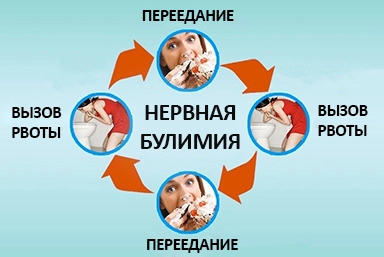 Лечение булимии в Усть-Камчатске